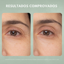 Kit Nuvae Retinew – Limpeza & Hidratação Perfeitas