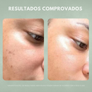 Kit Nuvae Retinew Com Cycloretin Renovação Completa