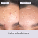 Kit Skincare