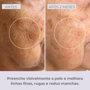 Retinol-like Bright Sérum +Niacinamide