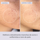 Retinol-like Bright Sérum +Niacinamide